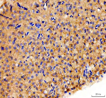 Zebrafish Dnm1 Antibody Liver Tissue IHC. Immunohistochemistry staining of FFPE zebrafish liver tissue with Zebrafish Dnm1 antibody, HRP-labeled secondary and DAB substrate. HIER: boil tissue sections in pH8 EDTA for 20 min and allow to cool before testing.