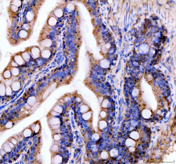 Zebrafish E-cadherin Antibody colon tissue IHC. Immunohistochemistry staining of FFPE zebrafish colon tissue with Zebrafish E-cadherin antibody, HRP-labeled secondary and DAB substrate. HIER: boil tissue sections in pH8 EDTA for 20 min and allow to cool before testing.