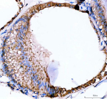 Zebrafish E-cadherin Antibody inner ear tissue IHC. Immunohistochemistry staining of FFPE zebrafish inner ear tissue with Zebrafish E-cadherin antibody, HRP-labeled secondary and DAB substrate. HIER: boil tissue sections in pH8 EDTA for 20 min and allow to cool before testing.