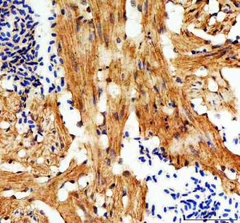Zebrafish E-cadherin Antibody heart tissue IHC. Immunohistochemistry staining of FFPE zebrafish heart tissue with Zebrafish E-cadherin antibody, HRP-labeled secondary and DAB substrate. HIER: boil tissue sections in pH8 EDTA for 20 min and allow to cool before testing.