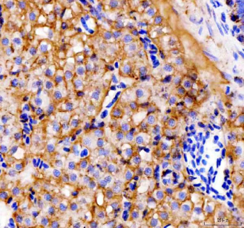 Zebrafish E-cadherin Antibody Kidney Tissue IHC. Immunohistochemistry staining of E-cadherin protein in FFPE zebrafish kidney tissue using Zebrafish E-cadherin antibody, HRP-labeled secondary and DAB substrate. Membranous staining is observed in epithelial cell populations, consistent with its role in cell-cell adhesion. HIER: boil tissue sections in pH8 EDTA for 20 min and allow to cool before testing.