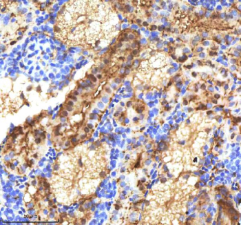 Zebrafish Etv2 Antibody Kidney Tissue IHC. Immunohistochemistry staining of FFPE zebrafish kidney tissue with Etv2 antibody, HRP-labeled secondary and DAB substrate. HIER: boil tissue sections in pH8 EDTA for 20 min and allow to cool before testing.