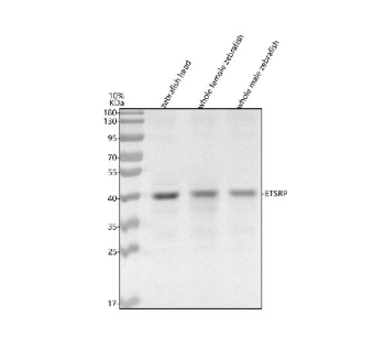 Zebrafish Etv2 Antibody Tissue WB. Western blot analysis of Etv2 protein using Zebrafish Etv2 antibody and 1) zebrafish head, 2) whole female zebrafish and 3) whole male zebrafish tissue lysate. Predicted molecular weight ~40 kDa.
