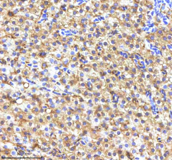 Zebrafish Fasn Antibody Liver Tissue IHC. Immunohistochemistry staining of FFPE zebrafish liver tissue with Fasn antibody, HRP-labeled secondary and DAB substrate. HIER: boil tissue sections in pH8 EDTA for 20 min and allow to cool before testing.