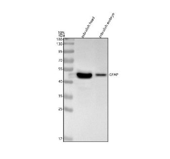 Zebrafish Gfap Antibody Tissue WB. Western blot analysis of Gfap protein using Zebrafish Gfap antibody and 1) zebrafish head tissue lysates and 2) zebrafish embryo tissue lysates. Predicted molecular weight ~51 kDa.