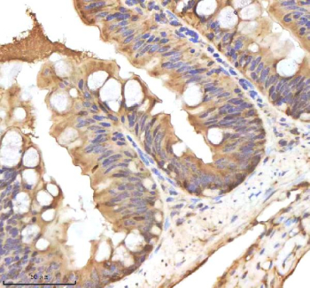 Zebrafish Hand2 Antibody Colon Tissue IHC. Immunohistochemistry staining of zebrafish HAND2 protein using Zebrafish HAND2 antibody, HRP-labeled secondary and DAB substrate. HAND2 was detected in a paraffin-embedded section of zebrafish colon tissue. HIER: boil tissue sections in pH8 EDTA for 20 min and allow to cool before testing.