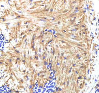 Zebrafish Hand2 Antibody Heart Tissue IHC. Immunohistochemistry IHC staining of zebrafish HAND2 protein using Zebrafish HAND2 antibody, HRP-labeled secondary and DAB substrate. HAND2 was detected in a paraffin-embedded section of zebrafish heart tissue. HIER: boil tissue sections in pH8 EDTA for 20 min and allow to cool before testing.