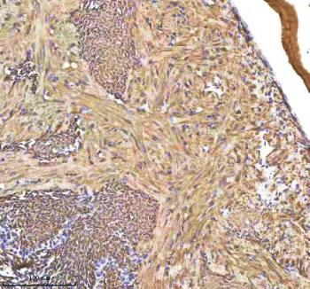 Zebrafish Hbae1.1 Antibody Heart Tissue IHC. Immunohistochemistry staining of FFPE zebrafish heart tissue with Hbae1.1 antibody, HRP-labeled secondary and DAB substrate. HIER: boil tissue sections in pH8 EDTA for 20 min and allow to cool before testing.