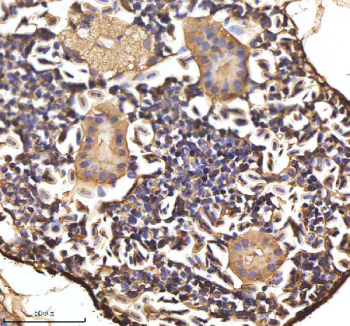 Zebrafish Hbae1.1 Antibody Kidney Tissue IHC. Immunohistochemistry staining of FFPE zebrafish kidney tissue with Hbae1.1 antibody, HRP-labeled secondary and DAB substrate. HIER: boil tissue sections in pH8 EDTA for 20 min and allow to cool before testing.