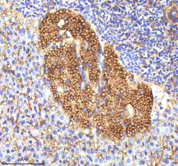 Zebrafish Igf1 Antibody Pancreas Tissue IHC. Immunohistochemistry staining of zebrafish Insulin like growth factor 1 protein using Zebrafish Insulin like growth factor 1 antibody, HRP-labeled secondary and DAB substrate. Igf1 was detected in a paraffin-embedded section of zebrafish pancreas tissue. HIER: boil tissue sections in pH8 EDTA for 20 min and allow to cool before testing.