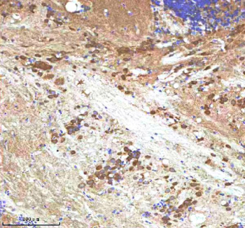 Zebrafish Igf1 Antibody Brain Tissue IHC. Immunohistochemistry staining of zebrafish Insulin like growth factor 1 protein using Zebrafish Insulin like growth factor 1 antibody, HRP-labeled secondary and DAB substrate. Igf1 was detected in a paraffin-embedded section of zebrafish brain tissue. HIER: boil tissue sections in pH8 EDTA for 20 min and allow to cool before testing.
