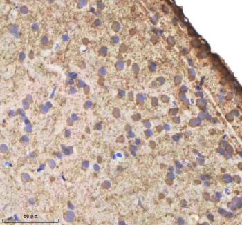 Zebrafish Il1b Antibody Brain Tissue IHC. Immunohistochemistry staining of zebrafish Interleukin 1 beta protein using Zebrafish Il1b antibody, HRP-labeled secondary and DAB substrate. Il-1 beta was detected in a paraffin-embedded section of zebrafish brain tissue. HIER: boil tissue sections in pH8 EDTA for 20 min and allow to cool before testing.