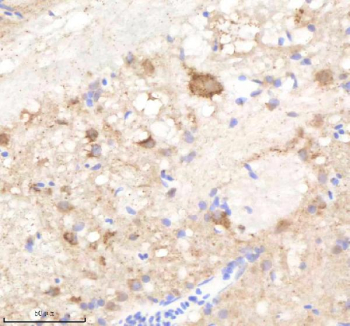 Zebrafish Pik3cb Antibody Brain Tissue IHC. Immunohistochemistry staining of FFPE zebrafish brain tissue with Pik3cb antibody, HRP-labeled secondary and DAB substrate. HIER: boil tissue sections in pH8 EDTA for 20 min and allow to cool before testing.