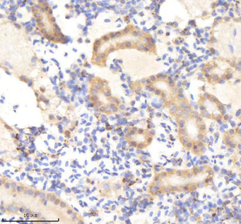 Zebrafish Pik3cb Antibody Kidney Tissue IHC. Immunohistochemistry staining of FFPE zebrafish kidney tissue with Pik3cb antibody, HRP-labeled secondary and DAB substrate. HIER: boil tissue sections in pH8 EDTA for 20 min and allow to cool before testing.