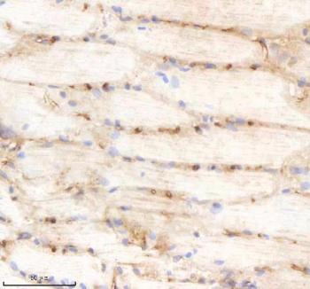 Zebrafish Pik3cb Antibody Muscle Tissue IHC. Immunohistochemistry staining of FFPE zebrafish muscle tissue with Pik3cb antibody, HRP-labeled secondary and DAB substrate. HIER: boil tissue sections in pH8 EDTA for 20 min and allow to cool before testing.