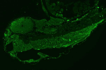 Zebrafish Leo1 Antibody Embryo Section IF. Immunofluorescent staining of Leo1 protein, also referred to as Leo1 PAF1 complex component, in zebrafish embryo tissue using Zebrafish Leo1 antibody (green). Distinct nuclear staining highlights widespread expression across developing embryonic structures, reflecting its role in gene expression control and early developmental processes. HIER: boil tissue sections in pH8 EDTA for 20 min and allow to cool before testing.