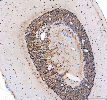 Zebrafish Leo1 Antibody Brain Tissue IHC. Immunohistochemistry staining of FFPE zebrafish brain tissue with Zebrafish Leo1 antibody, HRP-labeled secondary and DAB substrate. HIER: boil tissue sections in pH8 EDTA for 20 min and allow to cool before testing.