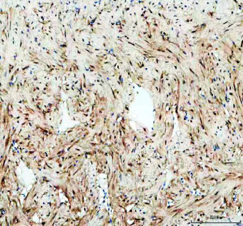 Zebrafish Leo1 Antibody Heart Tissue IHC. Immunohistochemistry staining of FFPE zebrafish heart tissue with Zebrafish Leo1 antibody, HRP-labeled secondary and DAB substrate. HIER: boil tissue sections in pH8 EDTA for 20 min and allow to cool before testing.