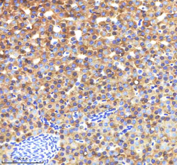 Zebrafish Lysozyme Antibody Liver Tissue IHC. Immunohistochemistry staining of FFPE zebrafish liver tissue with Zebrafish Lysozyme antibody, HRP-labeled secondary and DAB substrate. HIER: boil tissue sections in pH8 EDTA for 20 min and allow to cool before testing.