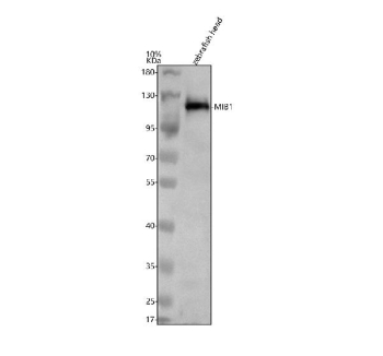 Zebrafish Mib1 Antibody Tissue WB. Western blot analysis of Mib1 protein using Zebrafish Mib1 antibody and 1) zebrafish head tissue lysates. Predicted molecular weight ~113 kDa.