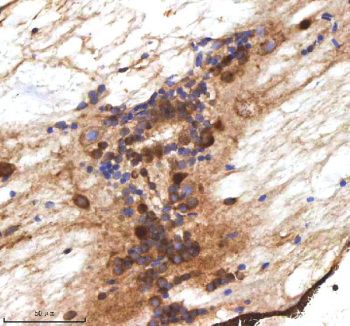 Zebrafish Mpeg1 Antibody Spinal Cord Tissue IHC. Immunohistochemistry staining of zebrafish Mpeg1 protein using Zebrafish Mpeg1 antibody, HRP-labeled secondary and DAB substrate. Mpeg1 was detected in a paraffin-embedded section of zebrafish spinal cord tissue. HIER: boil tissue sections in pH8 EDTA for 20 min and allow to cool before testing.