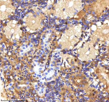 Zebrafish Mpeg1 Antibody Kidney Tissue IHC. Immunohistochemistry staining of zebrafish Mpeg1 protein using Zebrafish Mpeg1 antibody, HRP-labeled secondary and DAB substrate. Mpeg1 was detected in a paraffin-embedded section of zebrafish kidney tissue. HIER: boil tissue sections in pH8 EDTA for 20 min and allow to cool before testing.