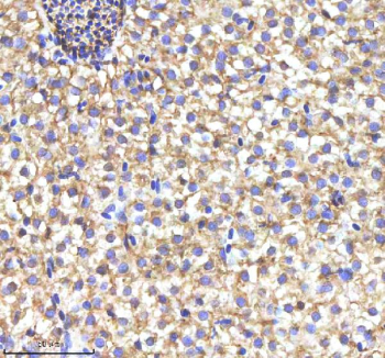 Zebrafish Myd88 Antibody Liver Tissue IHC. Immunohistochemistry staining of FFPE zebrafish liver tissue with Myd88 antibody, HRP-labeled secondary and DAB substrate. HIER: boil tissue sections in pH8 EDTA for 20 min and allow to cool before testing.