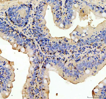 Zebrafish Myd88 Antibody Colon Tissue IHC. Immunohistochemistry staining of FFPE zebrafish colon tissue with Myd88 antibody, HRP-labeled secondary and DAB substrate. HIER: boil tissue sections in pH8 EDTA for 20 min and allow to cool before testing.