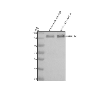 Zebrafish Ppp1r12a Antibody Tissue WB. Western blot analysis of Ppp1r12a protein using Zebrafish Ppp1r12a antibody and 1) whole female zebrafish and 2) whole male zebrafish tissue lysate. Predicted molecular weight ~117 kDa.
