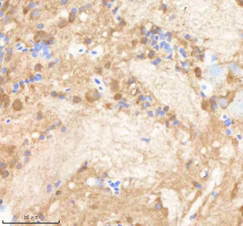 Zebrafish Ppp1r12a Antibody Brain Tissue IHC. Immunohistochemistry staining of FFPE zebrafish brain tissue with Ppp1r12a antibody, HRP-labeled secondary and DAB substrate. HIER: boil tissue sections in pH8 EDTA for 20 min and allow to cool before testing.