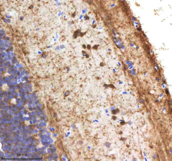 Zebrafish Nanos3 Antibody Brain Tissue IHC. Immunohistochemistry staining of zebrafish Nanos3 protein using Zebrafish Nanos3 antibody, HRP-labeled secondary and DAB substrate. Nanos3 was detected in a paraffin-embedded section of zebrafish brain tissue. HIER: boil tissue sections in pH8 EDTA for 20 min and allow to cool before testing.