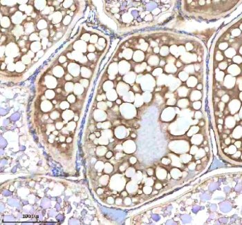 Zebrafish Nanos3 Antibody Ovary Tissue IHC. Immunohistochemistry staining of zebrafish Nanos3 protein using Zebrafish Nanos3 antibody, HRP-labeled secondary and DAB substrate. Nanos3 was detected in a paraffin-embedded section of zebrafish ovary tissue. HIER: boil tissue sections in pH8 EDTA for 20 min and allow to cool before testing.