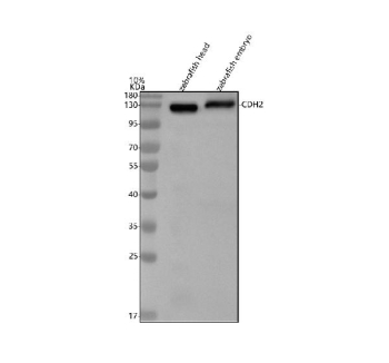 Zebrafish N-cadherin antibody Tissue WB. Western blot analysis of N-cadherin protein using Zebrafish N-cadherin antibody and 1) zebrafish head tissue lysates and 2) zebrafish embryo tissue lysate. Predicted molecular weight ~97 kDa but may be observed at higher molecular weights due to glycosylation.