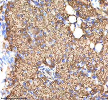Zebrafish Ndr1 Antibody Pancreas Tissue IHC. Immunohistochemistry staining of zebrafish Ndr1 protein using Zebrafish Ndr1 antibody, HRP-labeled secondary and DAB substrate. Ndr1 was detected in a paraffin-embedded section of zebrafish pancreas tissue. HIER: boil tissue sections in pH8 EDTA for 20 min and allow to cool before testing.