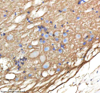 Zebrafish Ndr1 Antibody Spinal Cord Tissue IHC. Immunohistochemistry staining of zebrafish Ndr1 protein using Zebrafish Ndr1 antibody, HRP-labeled secondary and DAB substrate. Ndr1 was detected in a paraffin-embedded section of zebrafish spinal cord tissue. HIER: boil tissue sections in pH8 EDTA for 20 min and allow to cool before testing.