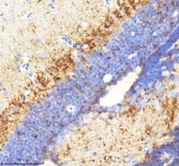 Zebrafish Neuropeptide Y Antibody Brain Tissue IHC. Immunohistochemistry staining of Danio rerio Npy protein using Zebrafish Neuropeptide Y antibody, HRP-labeled secondary and DAB substrate. Neuropeptide Y was detected in a paraffin-embedded section of zebrafish brain tissue. HIER: boil tissue sections in pH8 EDTA for 20 min and allow to cool before testing.