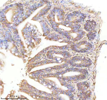 Zebrafish Neuropeptide Y Antibody Colon Tissue IHC. Immunohistochemistry staining of Danio rerio Npy protein using Zebrafish Neuropeptide Y antibody, HRP-labeled secondary and DAB substrate. Neuropeptide Y was detected in a paraffin-embedded section of zebrafish colon tissue. HIER: boil tissue sections in pH8 EDTA for 20 min and allow to cool before testing.