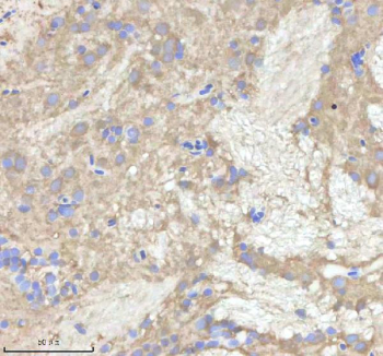 Zebrafish Npepps Antibody Brain Tissue IHC. Immunohistochemistry staining of zebrafish Npepps protein using Zebrafish Npepps antibody, HRP-labeled secondary and DAB substrate. Npepps was detected in a paraffin-embedded section of zebrafish brain tissue. HIER: boil tissue sections in pH8 EDTA for 20 min and allow to cool before testing.