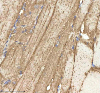 Zebrafish Npepps Antibody Muscle Tissue IHC. Immunohistochemistry staining of zebrafish Npepps protein using Zebrafish Npepps antibody, HRP-labeled secondary and DAB substrate. Npepps was detected in a paraffin-embedded section of zebrafish muscle tissue. HIER: boil tissue sections in pH8 EDTA for 20 min and allow to cool before testing.