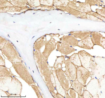 Zebrafish Nploc4 Antibody Muscle IHC. Immunohistochemistry staining of zebrafish Nploc4 protein using Zebrafish Nploc4 antibody, HRP-labeled secondary and DAB substrate. Nploc4 was detected in a paraffin-embedded section of zebrafish muscle tissue. HIER: boil tissue sections in pH8 EDTA for 20 min and allow to cool before testing.