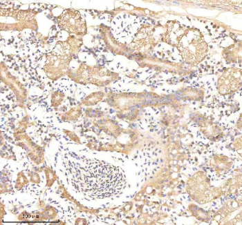 Zebrafish Ornithine aminotransferase / Oat Antibody Kidney Tissue IHC. Immunohistochemistry staining of zebrafish Ornithine aminotransferase protein using Zebrafish Ornithine aminotransferase antibody, HRP-labeled secondary and DAB substrate. Ornithine aminotransferase was detected in a paraffin-embedded section of zebrafish kidney tissue. HIER: boil tissue sections in pH8 EDTA for 20 min and allow to cool before testing.