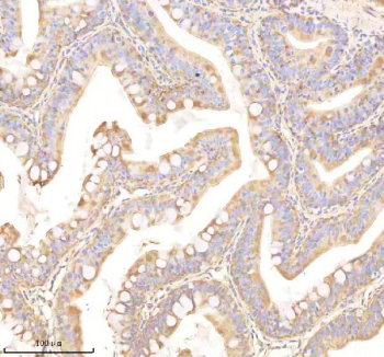 Zebrafish Ornithine aminotransferase / Oat Antibody Colon Tissue IHC. Immunohistochemistry staining of zebrafish Ornithine aminotransferase protein using Zebrafish Ornithine aminotransferase antibody, HRP-labeled secondary and DAB substrate. Ornithine aminotransferase was detected in a paraffin-embedded section of zebrafish colon tissue. HIER: boil tissue sections in pH8 EDTA for 20 min and allow to cool before testing.