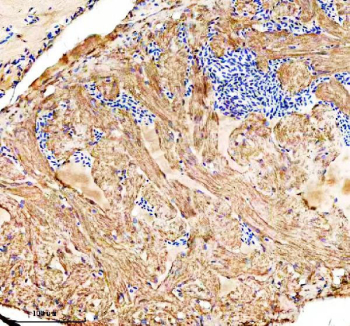 Zebrafish Ostf1 Antibody Heart Tissue IHC. Immunohistochemistry staining of FFPE zebrafish heart tissue with Ostf1 antibody, HRP-labeled secondary and DAB substrate. HIER: boil tissue sections in pH8 EDTA for 20 min and allow to cool before testing.