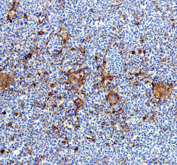 Zebrafish Ostf1 Antibody Spleen Tissue IHC. Immunohistochemistry staining of FFPE zebrafish spleen tissue with Ostf1 antibody, HRP-labeled secondary and DAB substrate. HIER: boil tissue sections in pH8 EDTA for 20 min and allow to cool before testing.