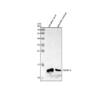Zebrafish Cdkn1a Antibody Tissue WB. Western blot analysis of Cdkn1a protein using Zebrafish Cdkn1a antibody and 1) zebrafish head tissue lysates and 2) zebrafish embryo tissue lysate. Predicted molecular weight ~15 kDa.