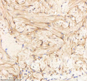 Zebrafish Pa2g4 Antibody Heart Tissue IHC. Immunohistochemistry staining of zebrafish Pa2g4 protein using Zebrafish Pa2g4 antibody, HRP-labeled secondary and DAB substrate. Pa2g4 was detected in a paraffin-embedded section of zebrafish heart tissue. HIER: boil tissue sections in pH8 EDTA for 20 min and allow to cool before testing.