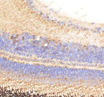 Zebrafish Pabpc4 Antibody Eye Tissue IHC. Immunohistochemistry staining of zebrafish Pabpc4 protein using Zebrafish Pabpc4 antibody, HRP-labeled secondary and DAB substrate. Pabpc4 was detected in a paraffin-embedded section of zebrafish eye tissue. HIER: boil tissue sections in pH8 EDTA for 20 min and allow to cool before testing.