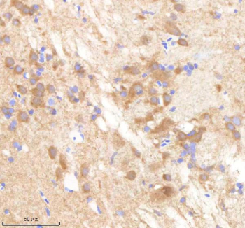 Zebrafish Pafah1b1 Antibody Brain Tissue IHC. Immunohistochemistry staining of FFPE zebrafish brain tissue with Pafah1b1 antibody, HRP-labeled secondary and DAB substrate. HIER: boil tissue sections in pH8 EDTA for 20 min and allow to cool before testing.