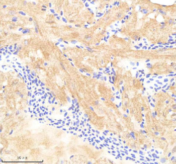 Zebrafish Pafah1b1 Antibody Heart Tissue IHC. Immunohistochemistry staining of FFPE zebrafish heart tissue with Pafah1b1 antibody, HRP-labeled secondary and DAB substrate. HIER: boil tissue sections in pH8 EDTA for 20 min and allow to cool before testing.