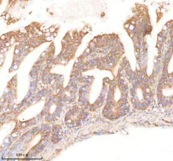 Zebrafish Pafah1b1 Antibody Colon Tissue IHC. Immunohistochemistry staining of FFPE zebrafish colon tissue with Pafah1b1 antibody, HRP-labeled secondary and DAB substrate. HIER: boil tissue sections in pH8 EDTA for 20 min and allow to cool before testing.